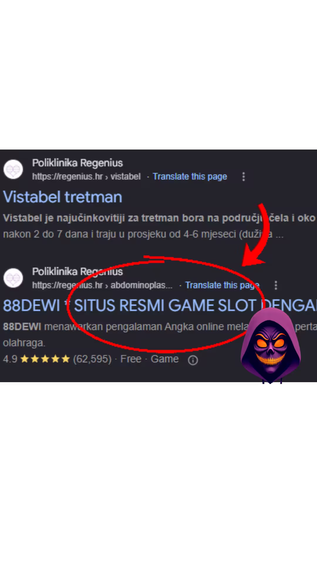 Google rezultati pretraživanja kompromitirane web stranice jedne poliklinike s neželjenim spam sadržajem